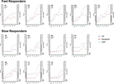 Inter-individual differences in muscle damage following a single bout of high-intense whole-body electromyostimulation